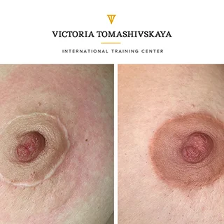 фото до и после коррекция ареолы татуажем мастер Томашивская Виктория