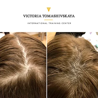 фото до и после татуаж волос на голове у женщин
